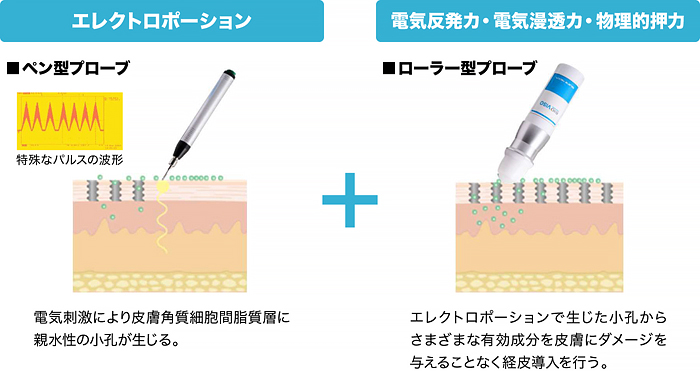 メソポレーション法